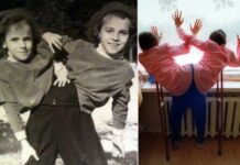 Ангел і демон в одному тілі: історія сіамських близнюків маші і даші кривошляпових