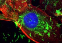 Бактерії при захворюваннях ясен прискорюють ріст раку молочної залози, з’ясувалося дослідження