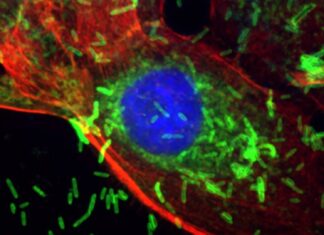Бактерії при захворюваннях ясен прискорюють ріст раку молочної залози, з’ясувалося дослідження