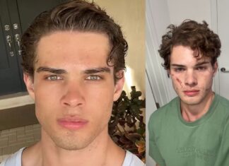 Ютубер Clavicular прокоментував ситуацію після підозр у передозуванні в Майамі